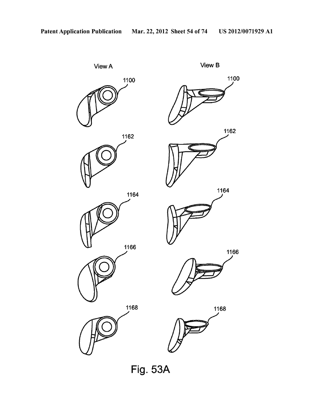 Linked Bilateral Spinal Facet Implants and Methods of Use - diagram, schematic, and image 55