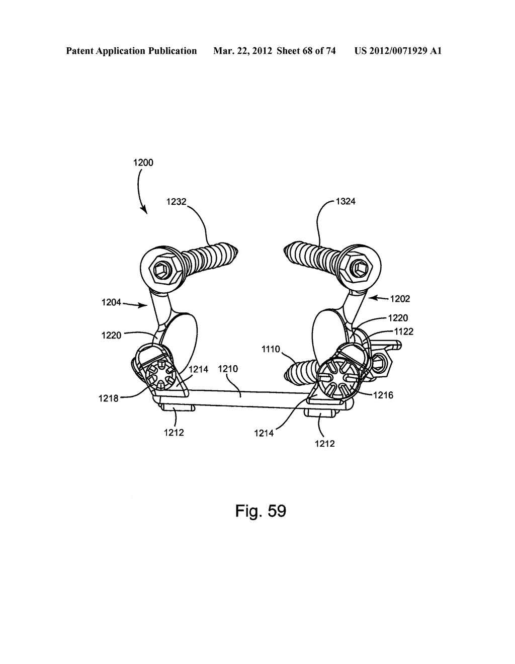 Linked Bilateral Spinal Facet Implants and Methods of Use - diagram, schematic, and image 69