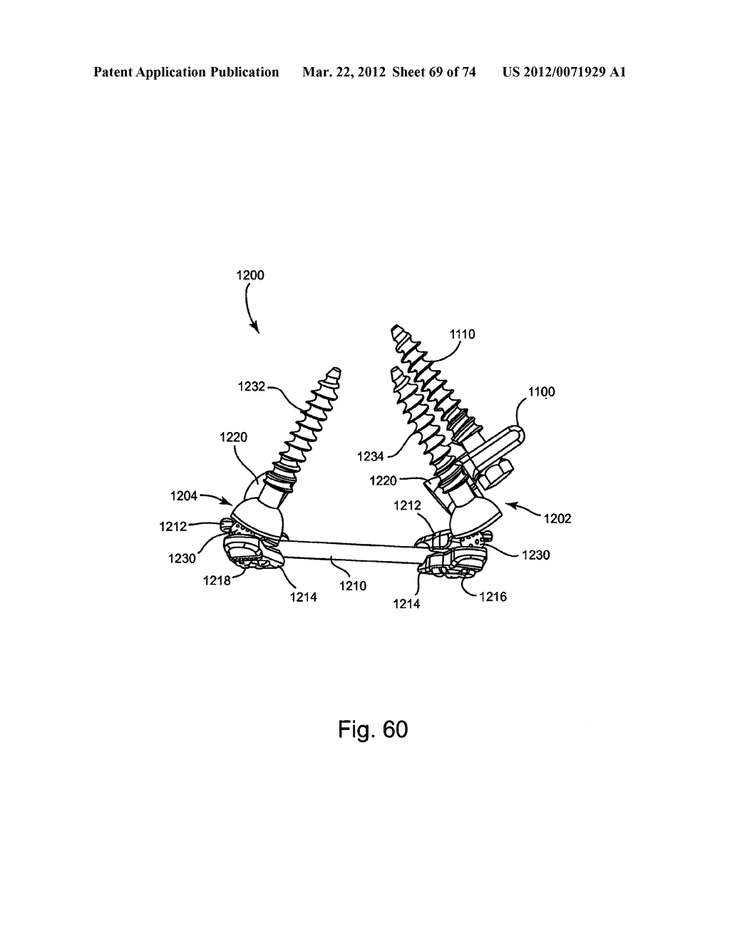 Linked Bilateral Spinal Facet Implants and Methods of Use - diagram, schematic, and image 70