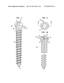 PEDICLE SCREW ASSEMBLY AND METHODS THEREFOR diagram and image