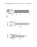 PEDICLE SCREW ASSEMBLY AND METHODS THEREFOR diagram and image