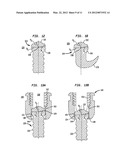 PEDICLE SCREW ASSEMBLY AND METHODS THEREFOR diagram and image