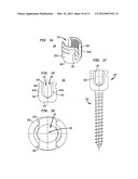 PEDICLE SCREW ASSEMBLY AND METHODS THEREFOR diagram and image