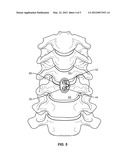 RETAINING  MECHANISM diagram and image