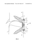 RETAINING  MECHANISM diagram and image