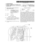 Subcutaneous Cardiac Sensing and Stimulation System diagram and image