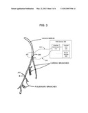 Methods And Apparatus For Treating Anaphylaxis Using Electrical Modulation diagram and image