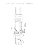 DEVICE AND METHOD FOR ASSISTING IN FLEXOR TENDON REPAIR AND REHABILITATION diagram and image