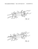 DEVICE AND METHOD FOR ASSISTING IN FLEXOR TENDON REPAIR AND REHABILITATION diagram and image