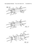 DEVICE AND METHOD FOR ASSISTING IN FLEXOR TENDON REPAIR AND REHABILITATION diagram and image