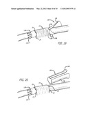 DEVICE AND METHOD FOR ASSISTING IN FLEXOR TENDON REPAIR AND REHABILITATION diagram and image