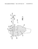 IMPLANTABLE CROSS-PIN FOR ANTERIOR CRUCIATE LIGAMENT REPAIR diagram and image