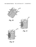 BONE GRAFTS diagram and image