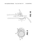 TISSUES PATCHES AND RELATED DELIVERY SYSTEMS AND METHODS diagram and image