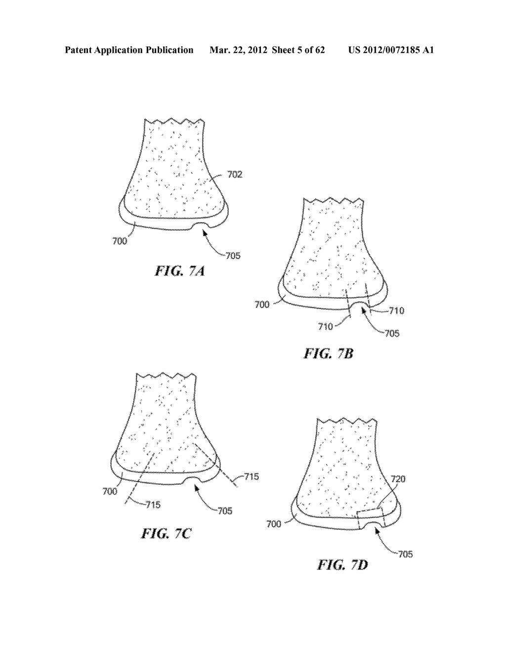 PATIENT SELECTABLE JOINT ARTHROPLASTY DEVICES AND SURGICAL TOOLS - diagram, schematic, and image 06