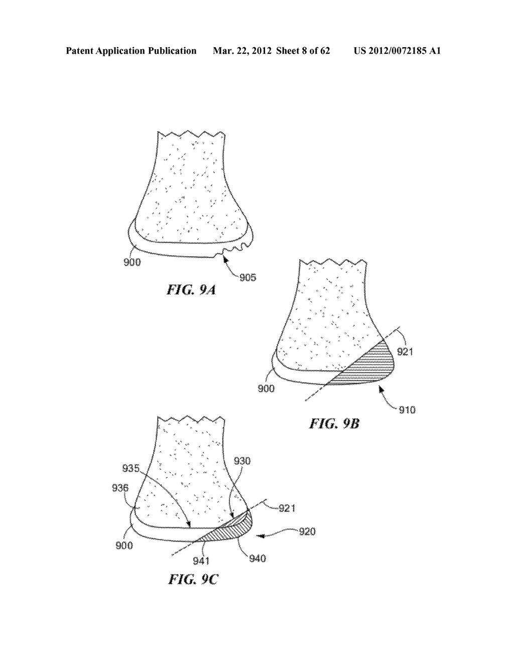 PATIENT SELECTABLE JOINT ARTHROPLASTY DEVICES AND SURGICAL TOOLS - diagram, schematic, and image 09