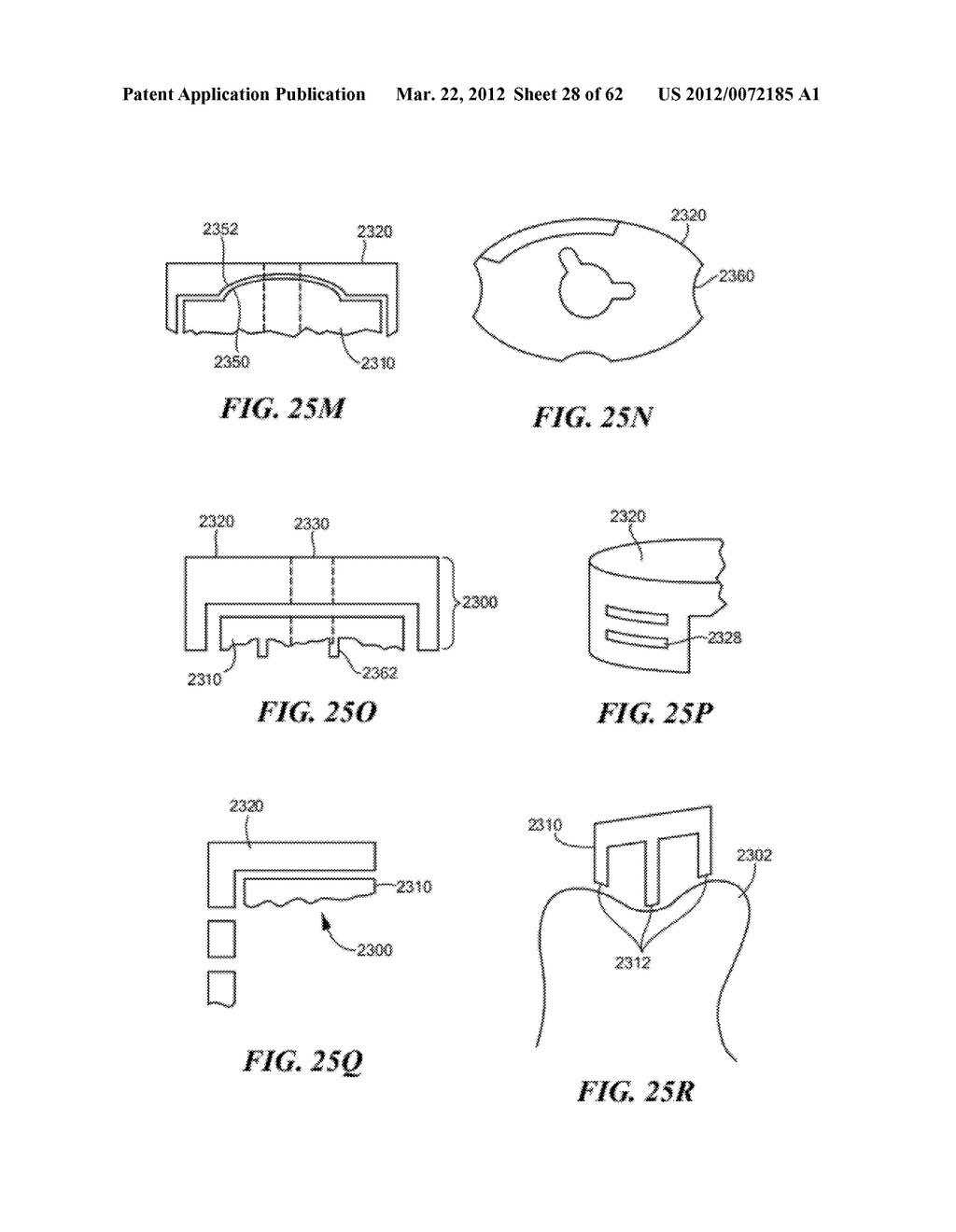 PATIENT SELECTABLE JOINT ARTHROPLASTY DEVICES AND SURGICAL TOOLS - diagram, schematic, and image 29