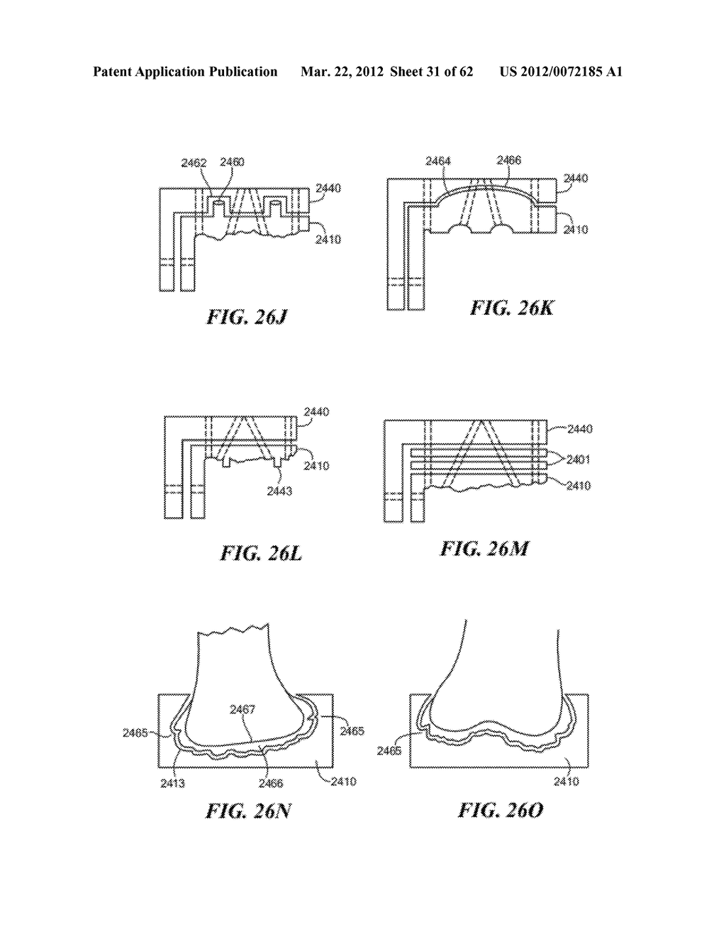 PATIENT SELECTABLE JOINT ARTHROPLASTY DEVICES AND SURGICAL TOOLS - diagram, schematic, and image 32