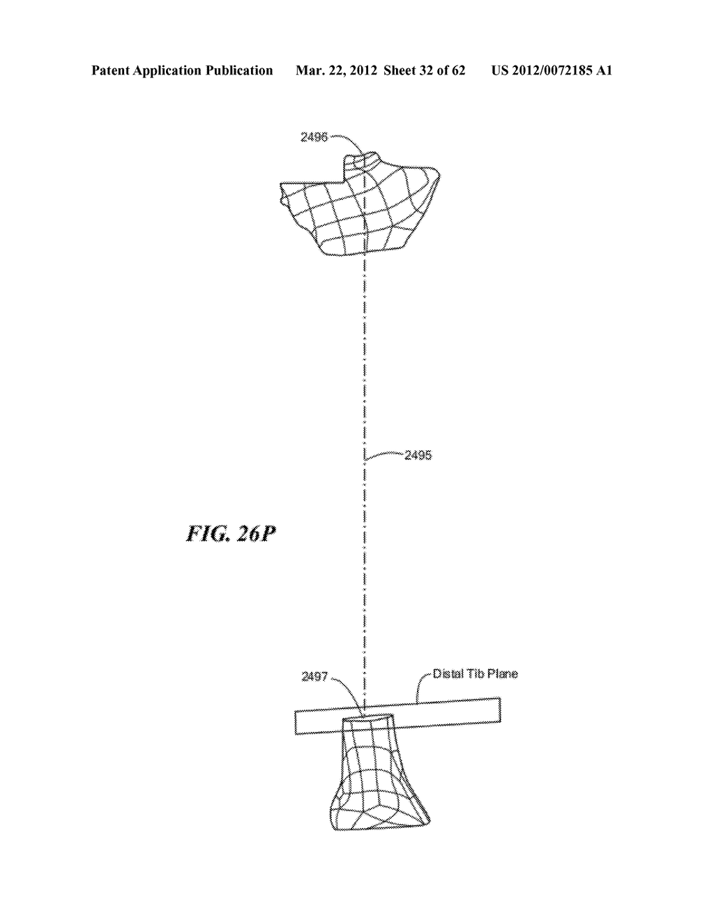 PATIENT SELECTABLE JOINT ARTHROPLASTY DEVICES AND SURGICAL TOOLS - diagram, schematic, and image 33