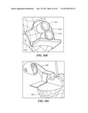 PATIENT SELECTABLE JOINT ARTHROPLASTY DEVICES AND SURGICAL TOOLS diagram and image