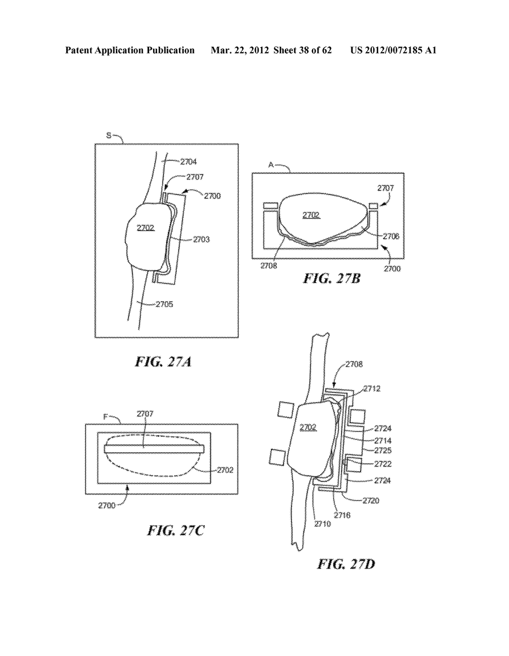 PATIENT SELECTABLE JOINT ARTHROPLASTY DEVICES AND SURGICAL TOOLS - diagram, schematic, and image 39