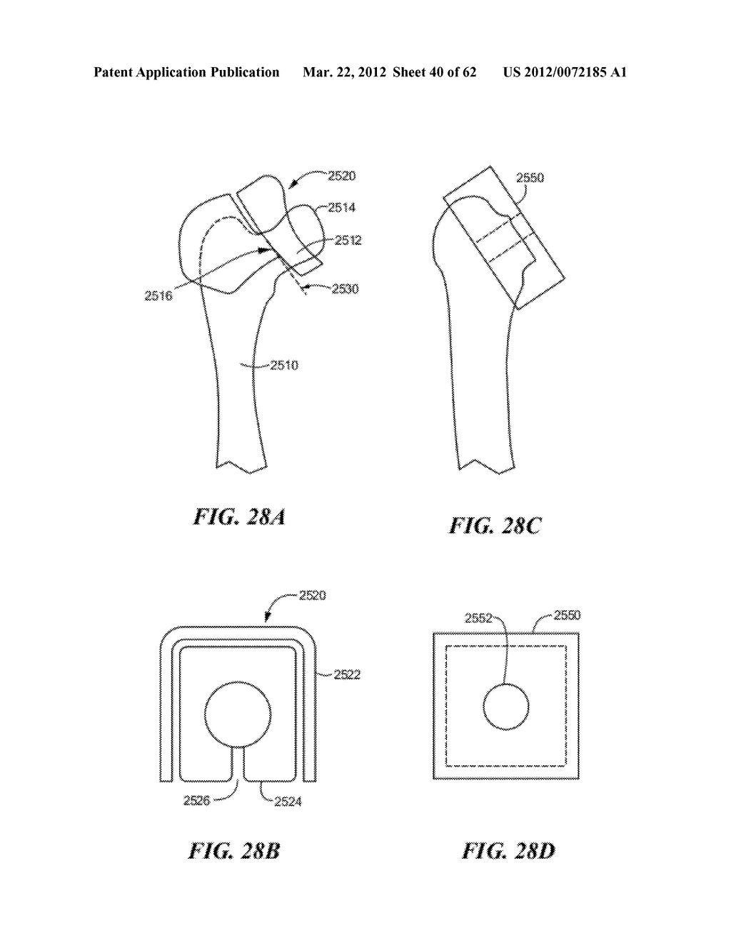 PATIENT SELECTABLE JOINT ARTHROPLASTY DEVICES AND SURGICAL TOOLS - diagram, schematic, and image 41