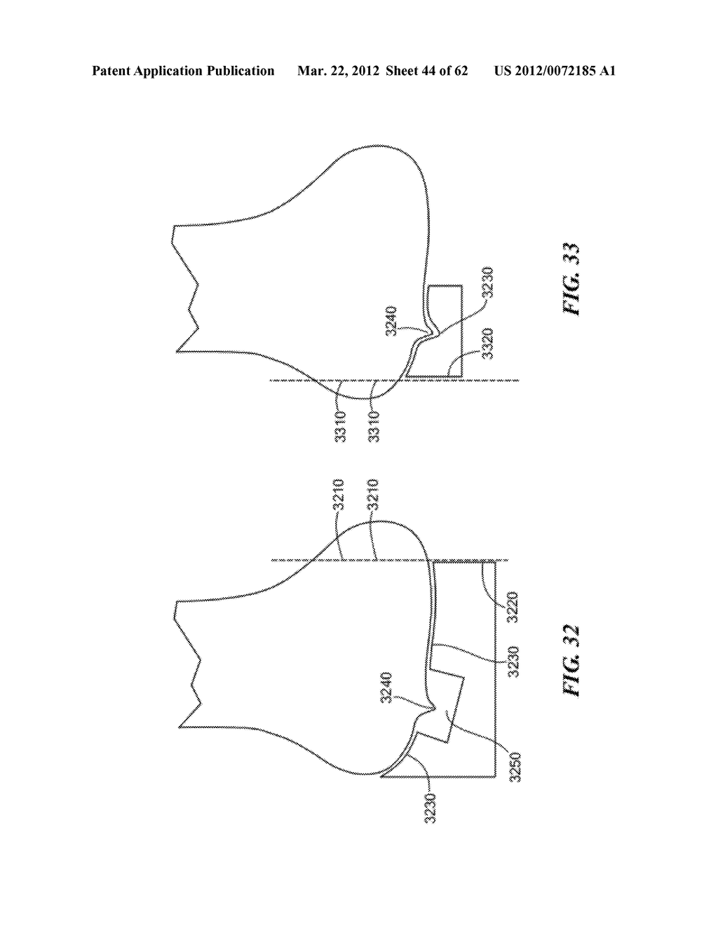 PATIENT SELECTABLE JOINT ARTHROPLASTY DEVICES AND SURGICAL TOOLS - diagram, schematic, and image 45