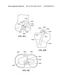 PATIENT SELECTABLE JOINT ARTHROPLASTY DEVICES AND SURGICAL TOOLS diagram and image