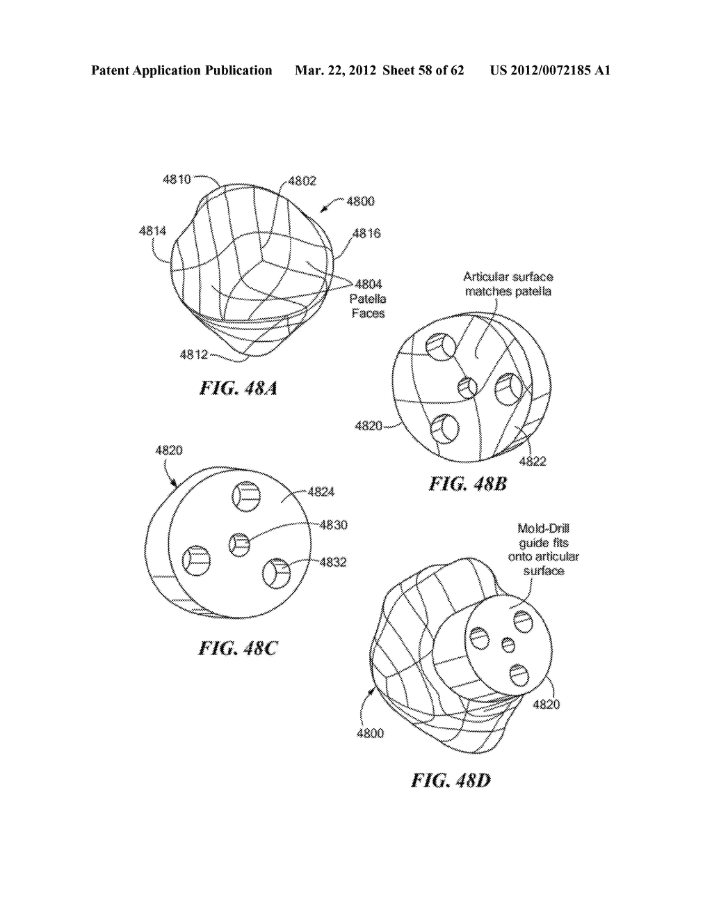 PATIENT SELECTABLE JOINT ARTHROPLASTY DEVICES AND SURGICAL TOOLS - diagram, schematic, and image 59