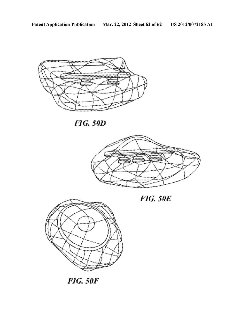 PATIENT SELECTABLE JOINT ARTHROPLASTY DEVICES AND SURGICAL TOOLS - diagram, schematic, and image 63