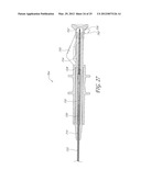 VALVE LOADER METHOD, SYSTEM, AND APPARATUS diagram and image