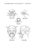 METHOD AND DEVICE FOR NON-INVASIVE VENTILATION WITH NASAL INTERFACE diagram and image