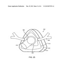 METHOD AND DEVICE FOR NON-INVASIVE VENTILATION WITH NASAL INTERFACE diagram and image