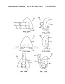 METHOD AND DEVICE FOR NON-INVASIVE VENTILATION WITH NASAL INTERFACE diagram and image