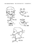 METHOD AND DEVICE FOR NON-INVASIVE VENTILATION WITH NASAL INTERFACE diagram and image