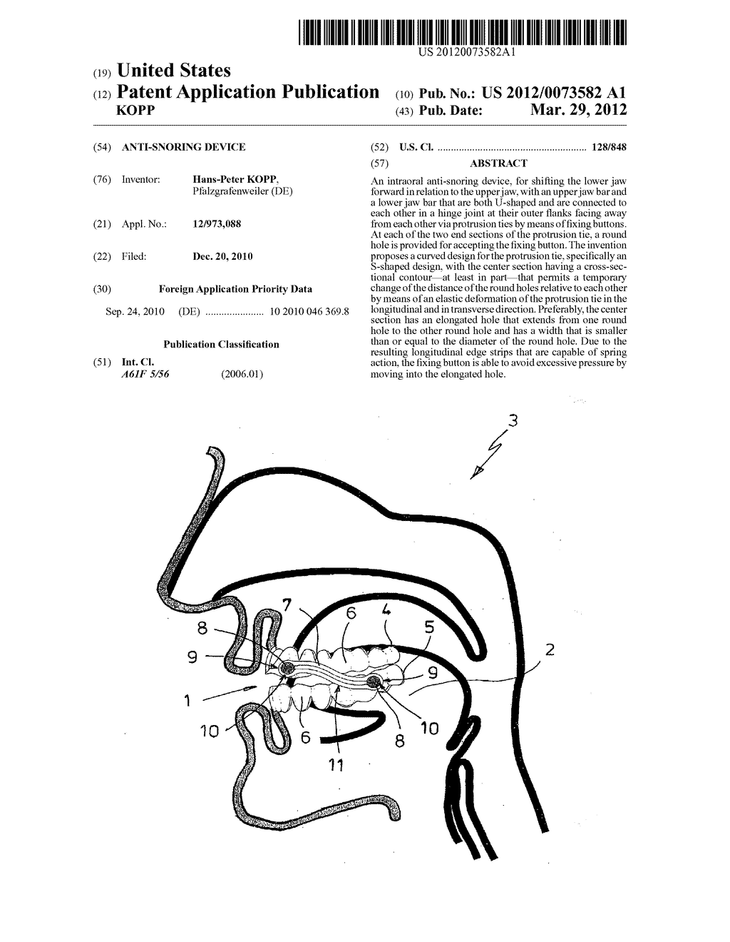 ANTI-SNORING DEVICE - diagram, schematic, and image 01