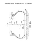 DISTRIBUTED PUMP SELF-INFLATING TIRE ASSEMBLY diagram and image