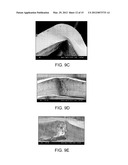 PROCESSES FOR MAKING CRUSH RECOVERABLE POLYMER SCAFFOLDS diagram and image