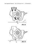 Swimming Pool Cleaner with a Rigid Debris Canister diagram and image