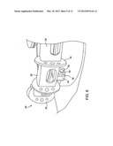 REMOTELY ACTIVATED TANK HATCH SYSTEM diagram and image