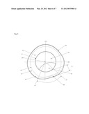 TRANSLATING PRESBYOPIC CONTACT LENS diagram and image