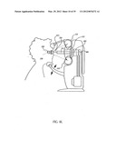 OCULAR RADIOSURGERY diagram and image