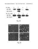 METHODS AND PHARMACEUTICAL COMPOSITIONS FOR HEALING WOUNDS diagram and image