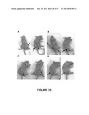 RECOMBINANT FUSION PROTEIN AND POLYNUCLEOTIDE CONSTRUCT FOR IMMUNOTOXIN     PRODUCTION diagram and image