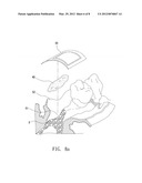 MEDICAL INSTRUMENT AND METHOD OF MANUFACTURING THE SAME diagram and image