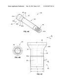 DENTAL ABUTMENT SYSTEM diagram and image