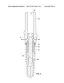 DENTAL ABUTMENT SYSTEM diagram and image