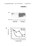 METHODS OF DIAGNOSING ALS diagram and image