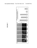 INFERTILITY ASSOCIATED DEFB-126 DELETION POLYMORPHISM diagram and image