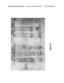 METHOD AND COMPOSITION USING A DUAL SPECIFICITY PROTEIN TYROSINE     PHOSPHATASE AS AN ANTIMALARIAL DRUG TARGET diagram and image